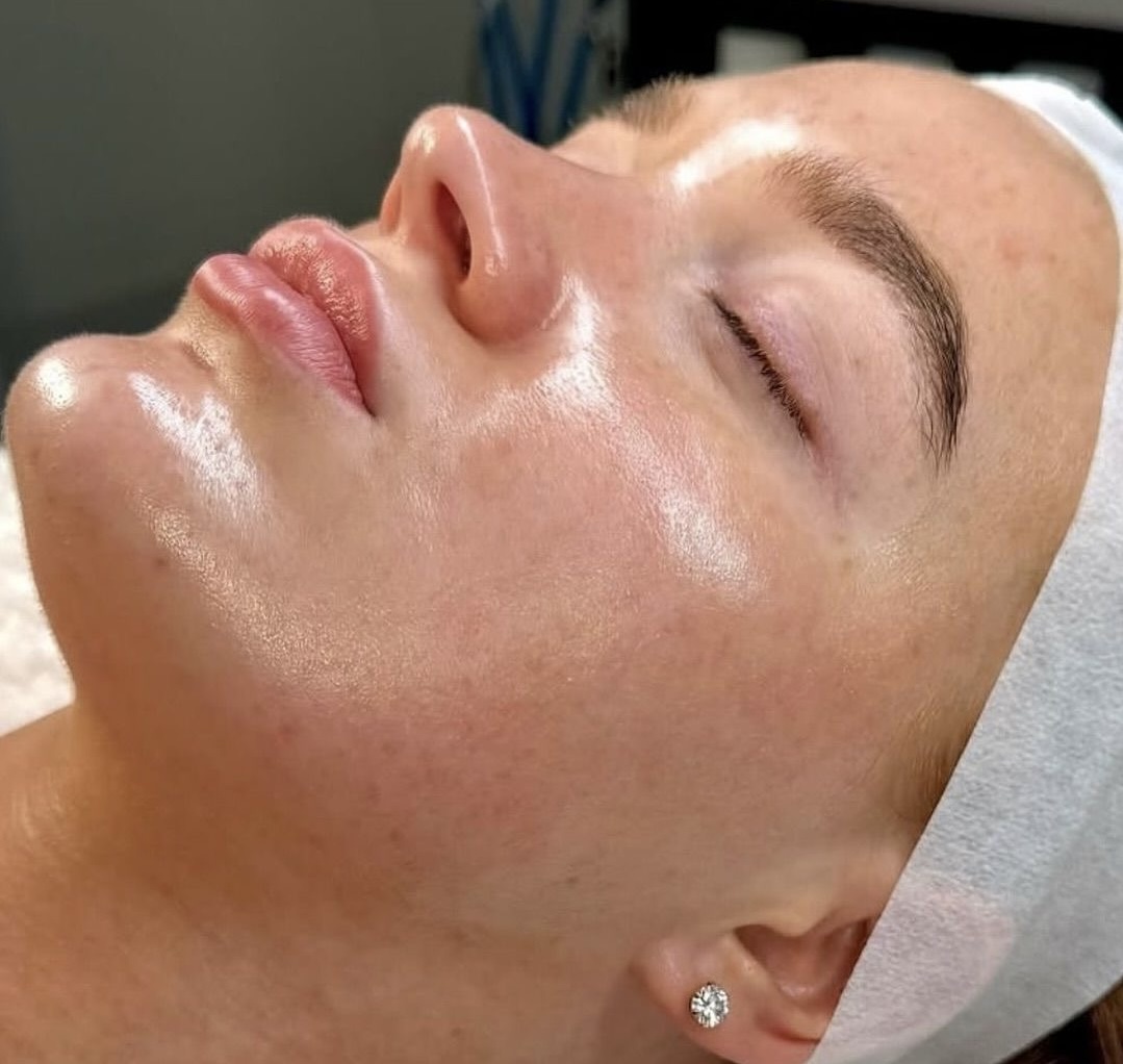 THE PEELING 2.0 CELESTETIC